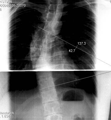 WS Röntgen Uniklinik Innsbruck