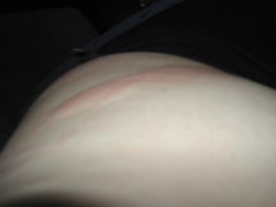 linke Seite