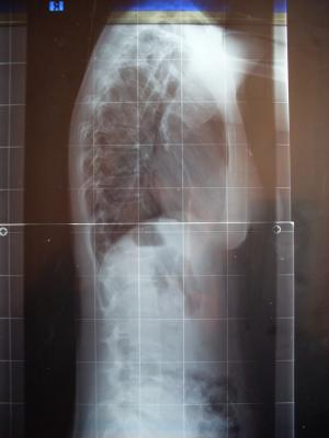sagittal one.jpg