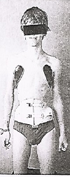 Balgrist frontal.jpg