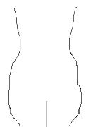 Tja, so sieht es ungefähr aus, aber meiner Meinung nach noch schlimmer (ich kann nicht gut mit Paint zeichnen)