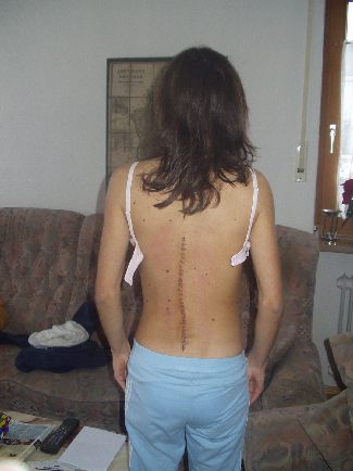 postoperativ.jpg