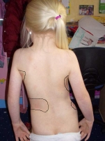 Denise-Druckstellen.jpg